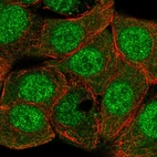 Immunofluorescent staining of human cell line MCF7 shows localization to nucleus & cytosol.