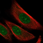 Immunofluorescent staining of human cell line PC-3 shows localization to nucleus, nucleoli & cytosol.