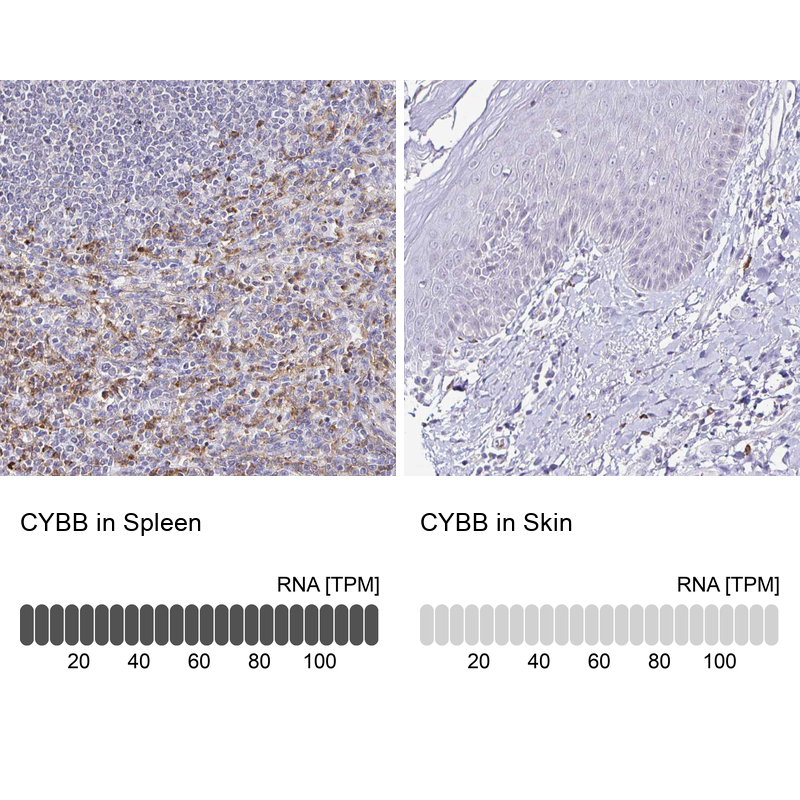 Anti-CYBB Antibody