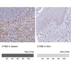 Anti-CYBB Antibody