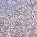 Immunohistochemical staining of human spleen shows moderate membranous and cytoplasmic positivity in cells in red pulp.