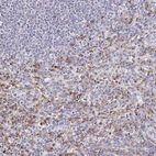 Immunohistochemical staining of human spleen shows moderate membranous and cytoplasmic positivity in cells in red pulp.