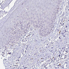Immunohistochemical staining of human skin shows no positivity in squamous epithelial cells as expected.