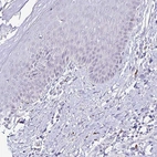 Immunohistochemical staining of human skin shows no positivity in squamous epithelial cells as expected.