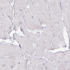Immunohistochemical staining of human skeletal muscle no positivity in myocytes as expected.