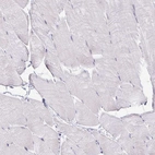 Immunohistochemical staining of human skeletal muscle no positivity in myocytes as expected.