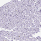 Immunohistochemical staining of human pancreas no positivity in exocrine glandular cells as expected.