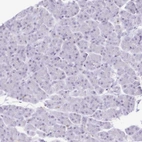 Immunohistochemical staining of human pancreas no positivity in exocrine glandular cells as expected.