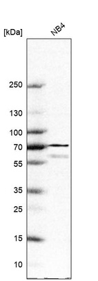 Western blot analysis in human cell line NB4.