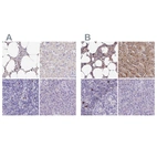 Immunohistochemical staining of human bone marrow, liver, lymph node and pancreas using Anti-CAT antibody HPA051282 (A) shows similar protein distribution across tissues to independent antibody HPA055838 (B).