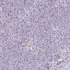 Immunohistochemical staining of human pancreas shows low expression as expected.