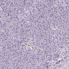 Immunohistochemical staining of human pancreas shows low expression as expected.