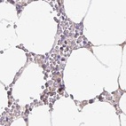 Immunohistochemical staining of human bone marrow using Anti-CAT antibody HPA051282.