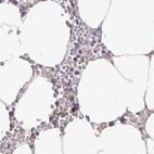Immunohistochemical staining of human bone marrow using Anti-CAT antibody HPA051282.