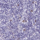 Immunohistochemical staining of human lymph node using Anti-CAT antibody HPA051282.