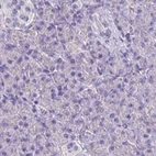 Immunohistochemical staining of human pancreas using Anti-CAT antibody HPA051282.