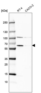 Western blot analysis in human cell line RT-4 and human cell line CACO-2.