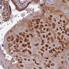 Anti-GBGT1 Antibody