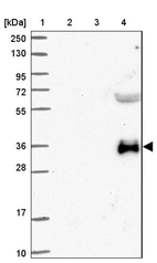 Lane 1: Marker [kDa] 250, 130, 95, 72, 55, 36, 28, 17, 10_br/_Lane 2: Human cell line RT-4_br/_Lane 3: Human cell line U-251MG sp_br/_Lane 4: Human plasma (IgG/HSA depleted)