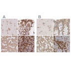 Anti-RPN1 Antibody
