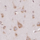 Immunohistochemical staining of human cerebral cortex using Anti-RPN1 antibody HPA051520.