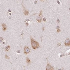 Immunohistochemical staining of human cerebral cortex using Anti-RPN1 antibody HPA051520.