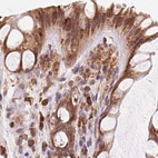 Immunohistochemical staining of human colon using Anti-RPN1 antibody HPA051520.