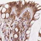 Immunohistochemical staining of human colon using Anti-RPN1 antibody HPA051520.