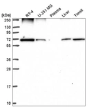 Western blot analysis in human cell line RT-4, human cell line U-251 MG, human plasma, human liver tissue and human tonsil tissue.