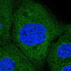 Immunofluorescent staining of human cell line A-431 shows localization to endoplasmic reticulum.