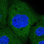 Anti-RPN1 Antibody