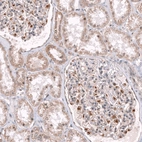 Anti-NELL1 Antibody