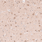 Immunohistochemical staining of human cerebral cortex shows moderate cytoplasmic positivity in neurons.