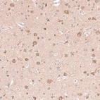 Immunohistochemical staining of human cerebral cortex shows moderate cytoplasmic positivity in neurons.