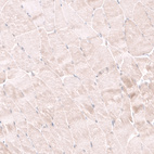 Immunohistochemical staining of human skeletal muscle shows negative to very weak positivity in myocytes.