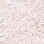 Immunohistochemical staining of human skeletal muscle shows negative to very weak positivity in myocytes.