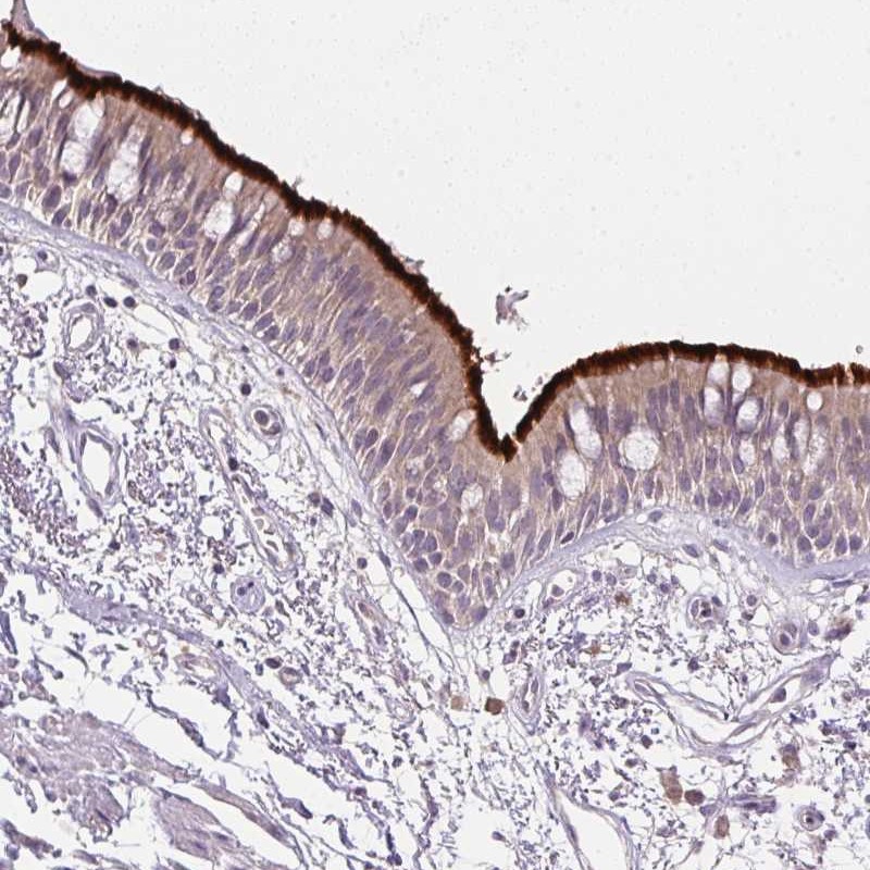 Anti-SPACA9 Antibody