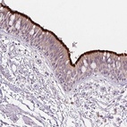 Anti-SPACA9 Antibody