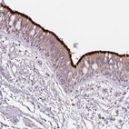 Anti-SPACA9 Antibody