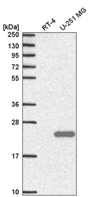 Western blot analysis in human cell line RT-4 and human cell line U-251 MG.