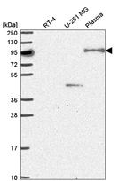 Anti-NOM1 Antibody