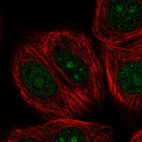 Anti-NOM1 Antibody
