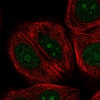Immunofluorescent staining of human cell line MCF7 shows localization to nucleus & nucleoli.