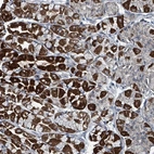 Anti-ABHD18 Antibody