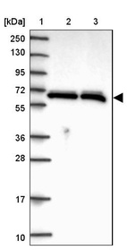 Lane 1: Marker [kDa] 250, 130, 95, 72, 55, 36, 28, 17, 10_br/_Lane 2: Human cell line RT-4_br/_Lane 3: Human cell line U-251MG sp