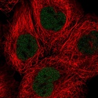 Anti-SOX13 Antibody