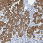 Immunohistochemical staining of human pancreas shows moderate to strong cytoplasmic positivity in exocrine glandular cells.