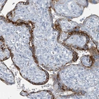 Immunohistochemical staining of human placenta shows strong cytoplasmic positivity in trophoblastic cells.