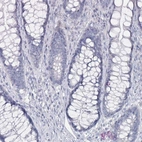 Immunohistochemical staining of human rectum shows no positivity in glandular cells as expected.