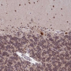Anti-BRD3 Antibody